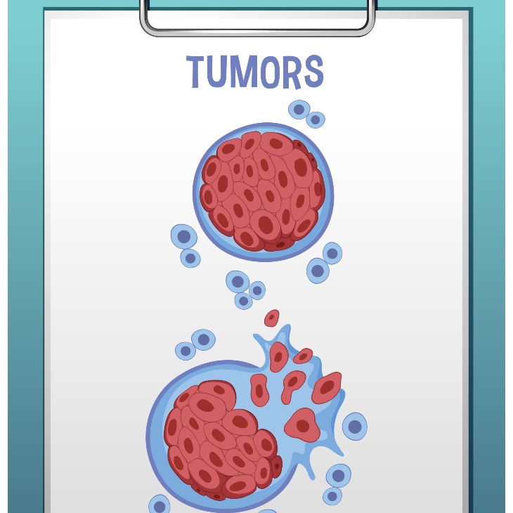 Cara Mencegah Tumor: Tips Efektif untuk Kesehatan yang Optimal